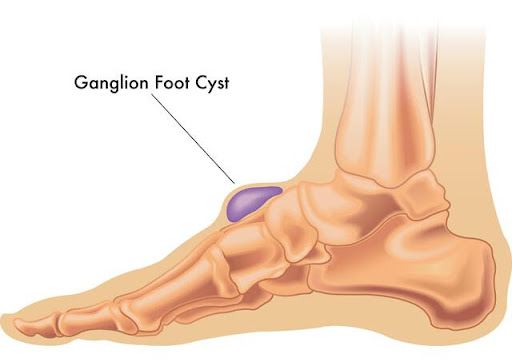 Ganglion