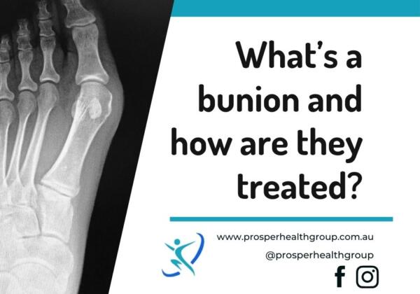Bunion Blog (2)